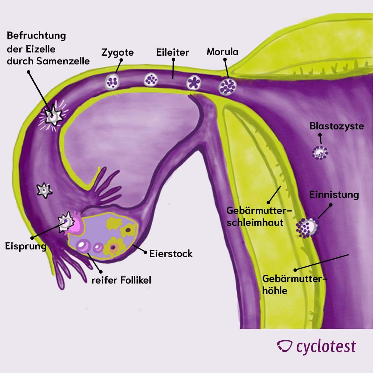 Wenn die Eizelle nach ihrer Befruchtung in der Gebärmutterschleimhaut andockt, kann es zum Einnistungsschmerz kommen.