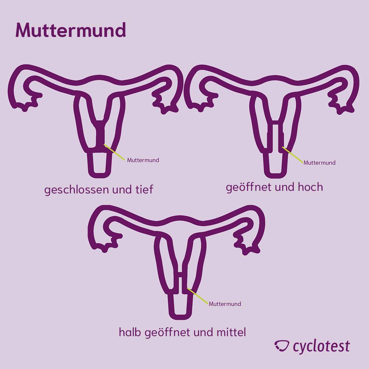 Lage und Öffnung des Muttermunds im weiblichen Zyklus