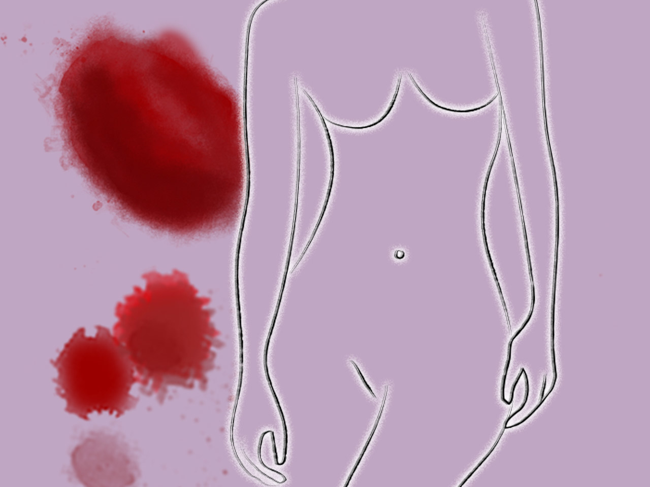 Unter Schmierblutung, auch Zwischenblutung oder Spotting genannt, leiden viele Frauen.